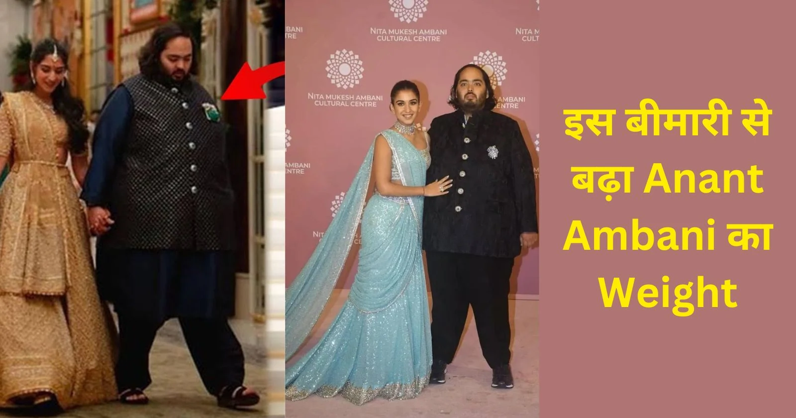 इस बीमारी से बढ़ा Anant Ambani का Weight, 19 साल की उम्र में 208 किलो हो गया था वजन
